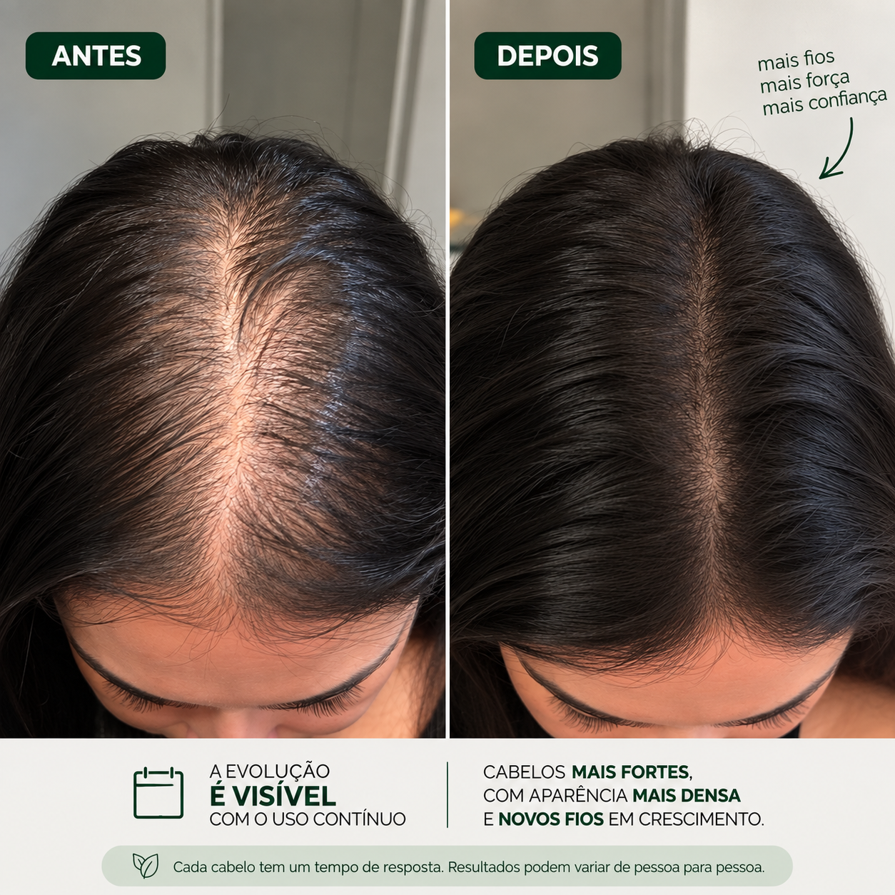 Antes e depois feminino ilustrativo Socorro Pro